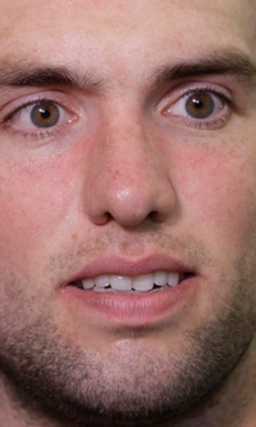 Luck eager to start throwing as offseason rehab continues